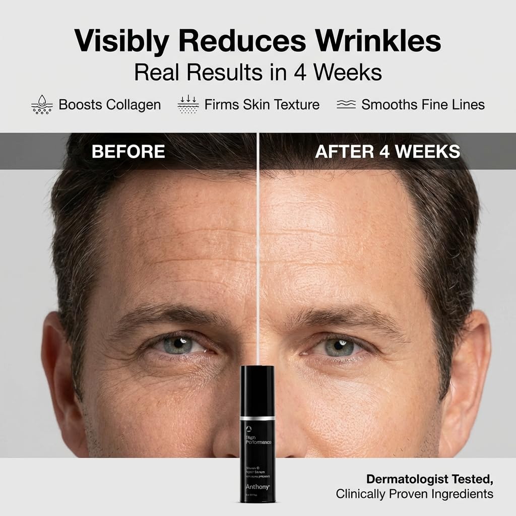 Unlocking Radiant Skin with Anthony's High Performance Vitamin C Cream Treatment